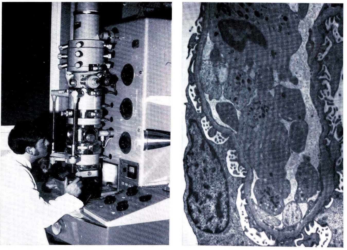 Electron microscope and 8,000x magnification blood vessel in kidney