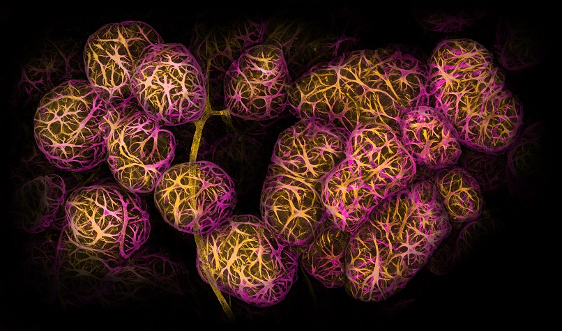 In Bloom – Breast tissue showing muscle-like cells: Dr Caleb Dawson | WEHI. In Bloom – Breast tissue showing muscle-like cells: Dr Caleb Dawson | WEHI.