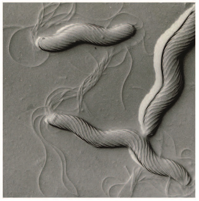 An electron-microscope image of Helicobacter muridarum, demonstrating its helical shape