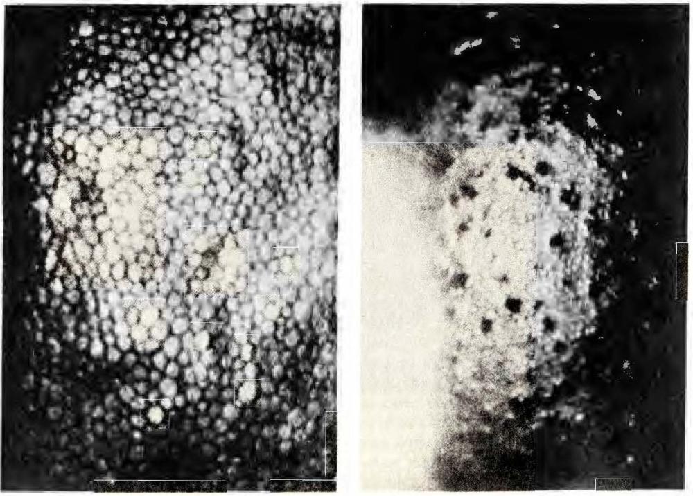 Photos with comparison of a corneal endothelium with and without changes in appearance from contact lenses.