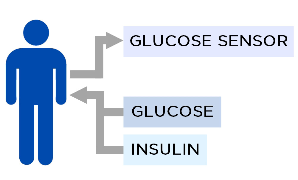 Diagram: Figure of a person. Arrow from person to glucose sensor. Arrow from Glucose and Insulin to person.