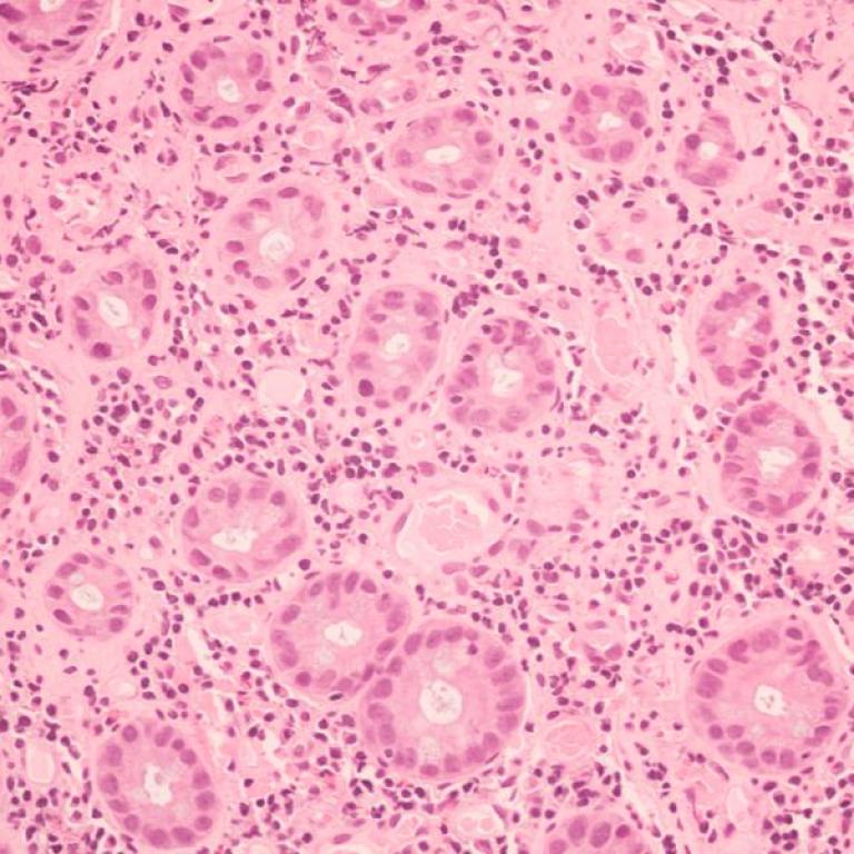 Under the microscope pink cells stock photo