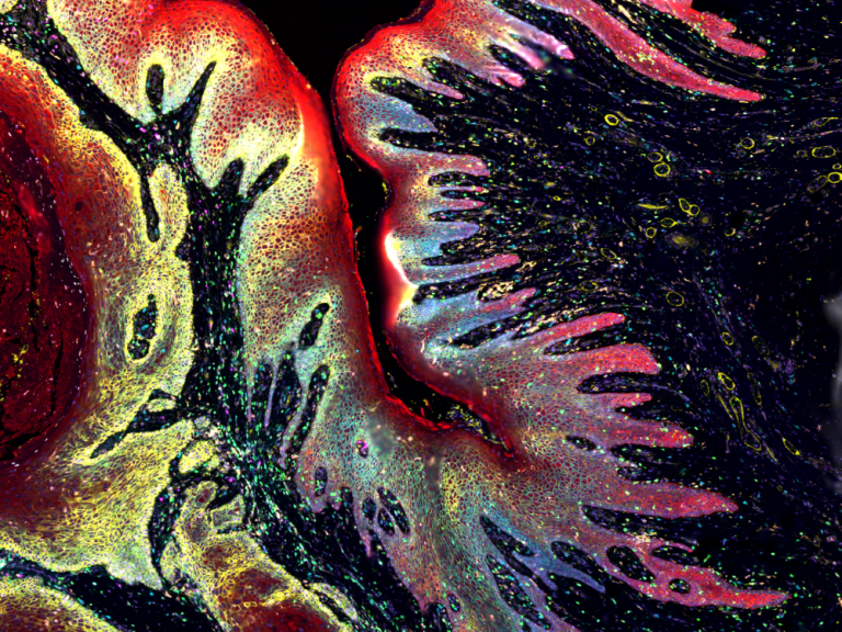 2025 Science to Art winner artwork 'Battleground beneath the skin'