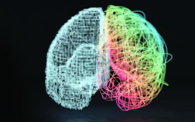 Scan of a brain