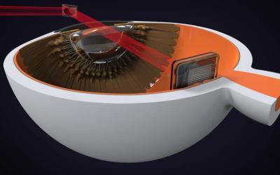 bionic eye